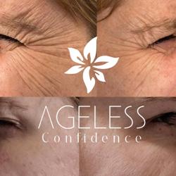 Ageless Confidence