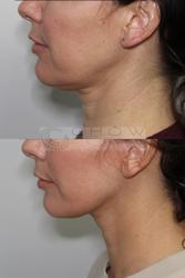 Chow Center For Facial Plastic Surgery