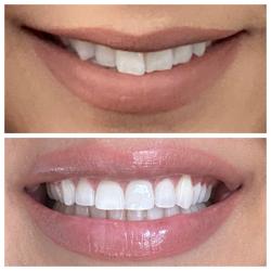 Waterman Dentistry, Family Dentistry, Orthodontic Braces, Dental Implants, & Cosmetic Dentistry