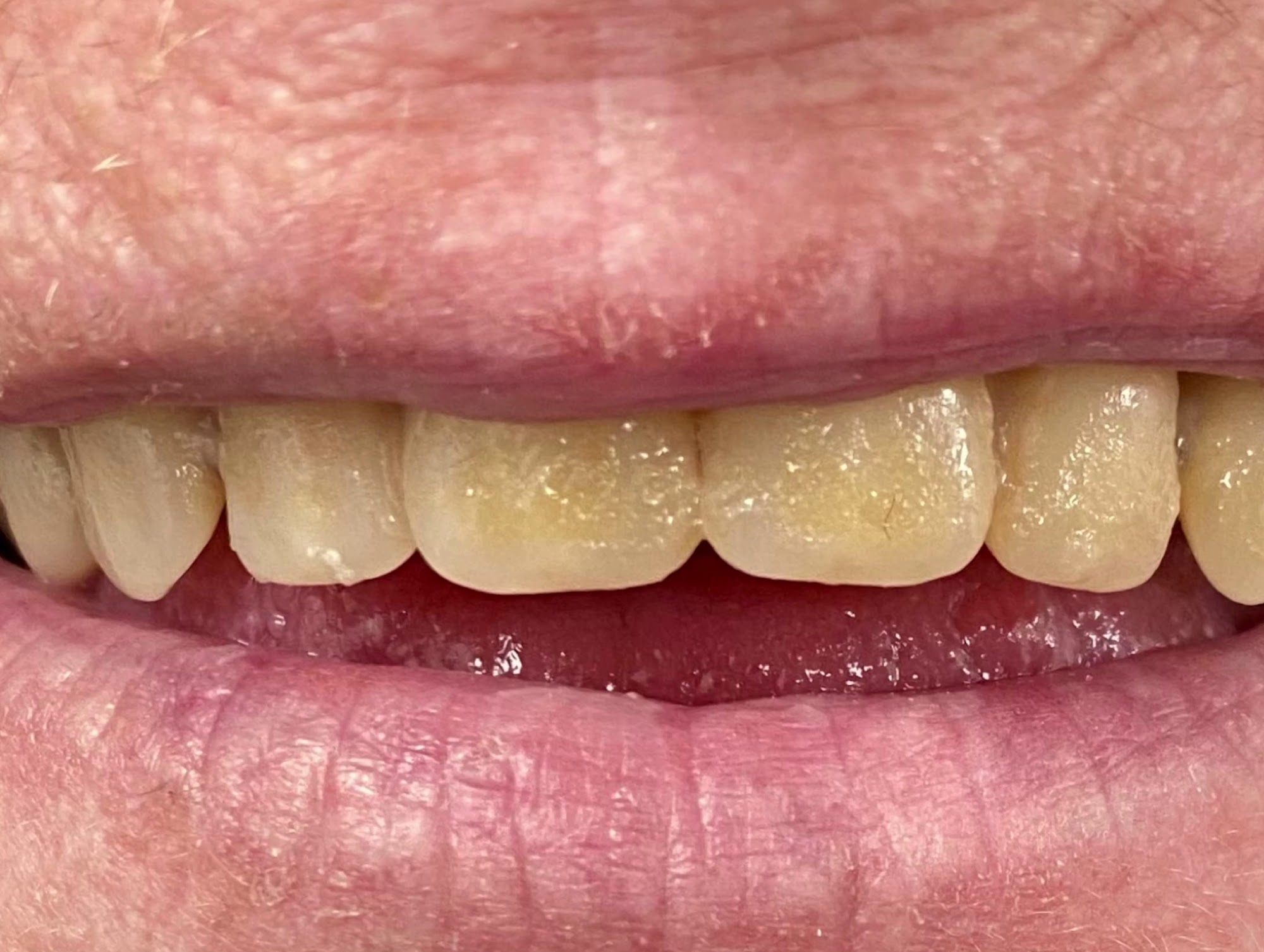 Allerdale Denture Clinic