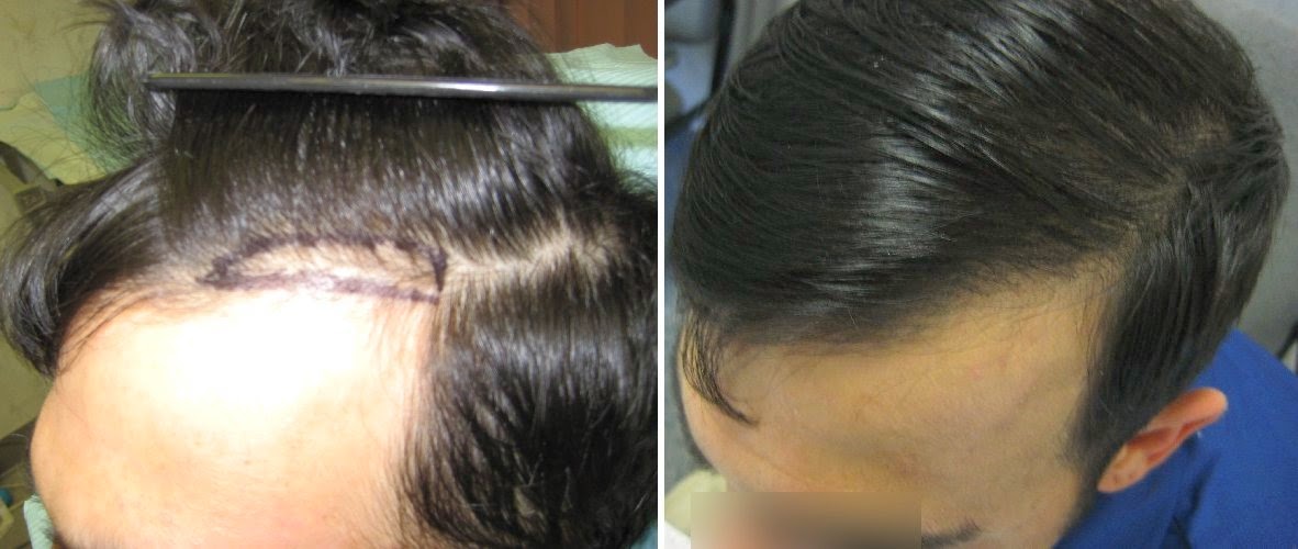 Dr. Shapiro's Hair Institute