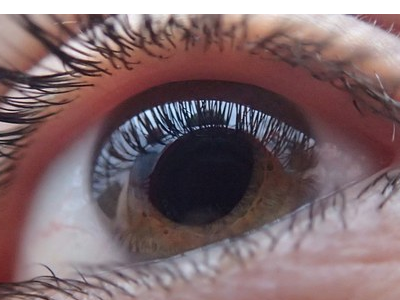 Bridgford Opticians