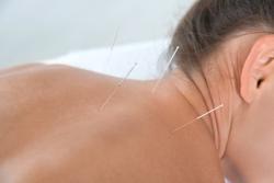 Dr. Peter Ahn - Medical Acupuncture