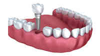 PearlFection Dentistry - Urbana