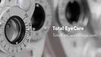 Total Eye Care | Billings Eye Doctor