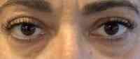 Sleeping Beauty Lash