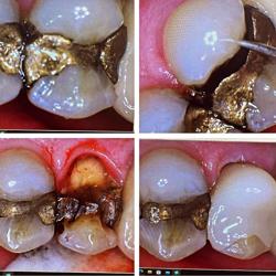 Mason Elite Dentistry - Dr. Natalie Stewart