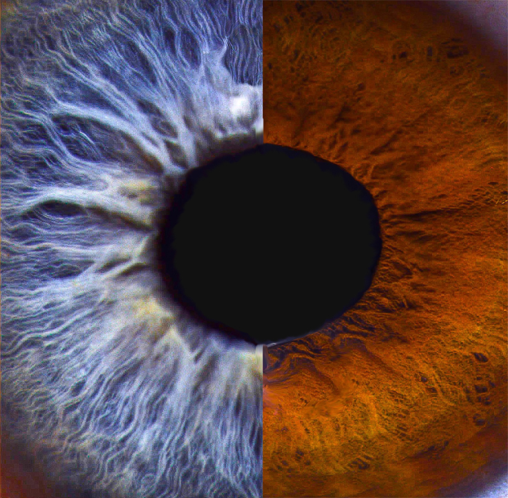 Issaquah Optometric Center