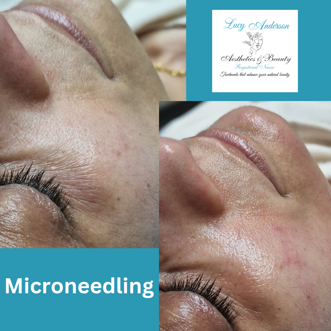 Lucy Anderson Aesthetics & Beauty Swindon